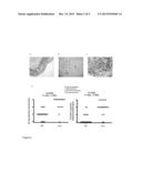 USE OF OLFACTOMEDIN-4 PROTEIN (OLFM4) IN COLORECTAL CANCER DIAGNOSIS diagram and image