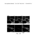 NANOMEDICINES FOR EARLY NERVE REPAIR diagram and image