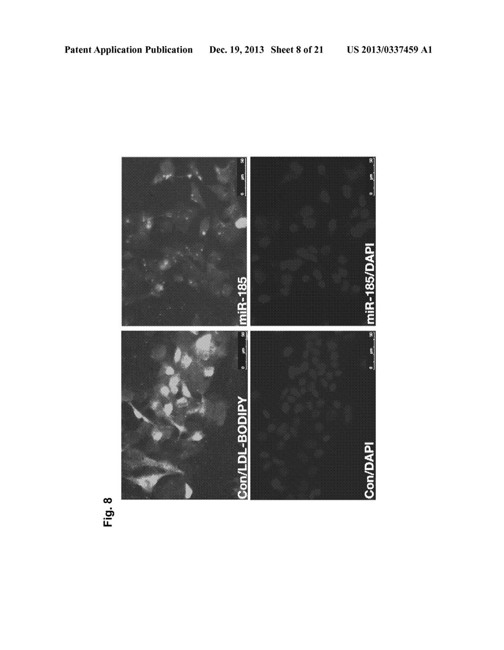 A METHOD OF ENHANCING MIR-185 EXPRESSION TO REDUCE LOW DENSITY     LIPOPROTEIN/CHOLESTEROL ACCUMULATION IN A CELL - diagram, schematic, and image 09