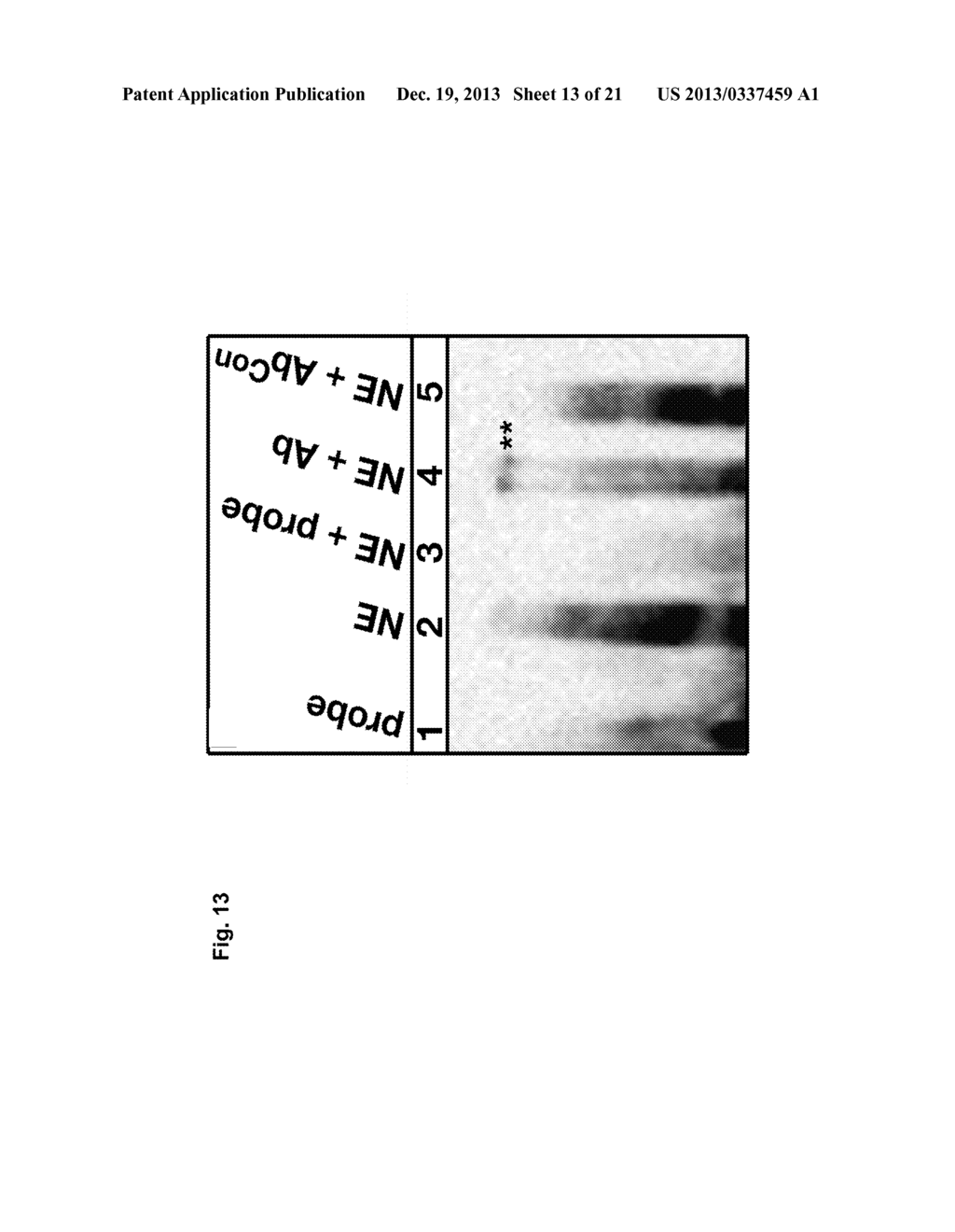 A METHOD OF ENHANCING MIR-185 EXPRESSION TO REDUCE LOW DENSITY     LIPOPROTEIN/CHOLESTEROL ACCUMULATION IN A CELL - diagram, schematic, and image 14