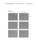 TAZ/WWTR1 FOR DIAGNOSIS AND TREATMENT OF CANCER diagram and image