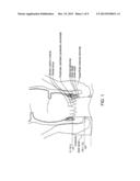 FECAL INCONTINENCE DEVICE, SYSTEM AND METHOD diagram and image