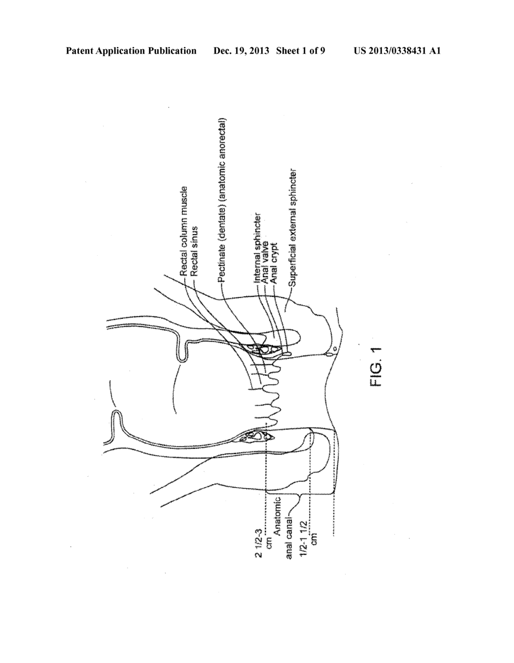 FECAL INCONTINENCE DEVICE, SYSTEM AND METHOD - diagram, schematic, and image 02