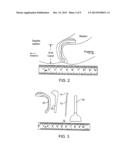 FECAL INCONTINENCE DEVICE, SYSTEM AND METHOD diagram and image