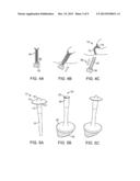 FECAL INCONTINENCE DEVICE, SYSTEM AND METHOD diagram and image