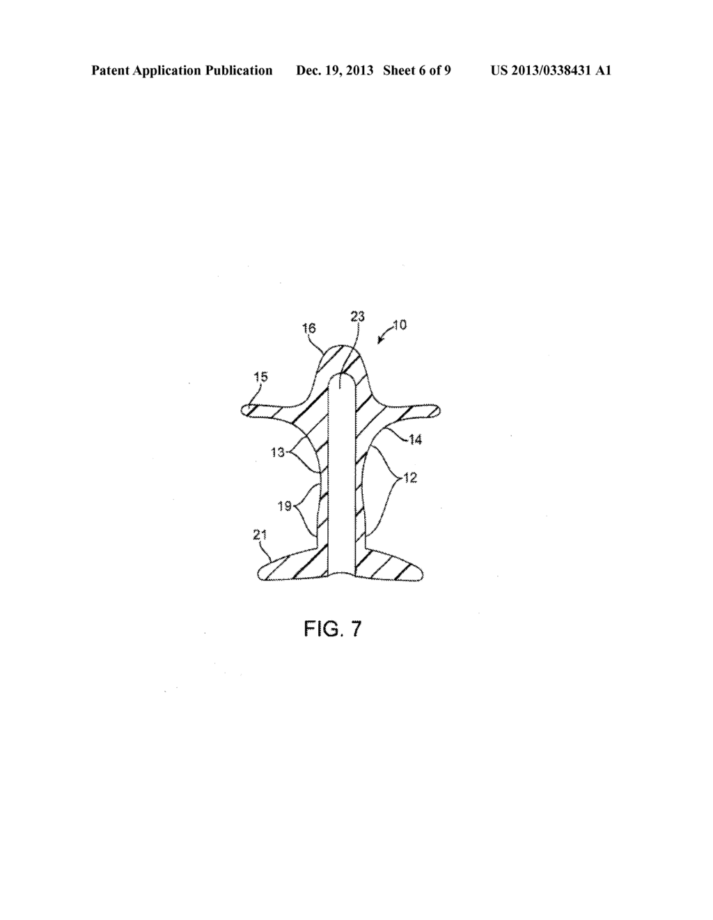 FECAL INCONTINENCE DEVICE, SYSTEM AND METHOD - diagram, schematic, and image 07