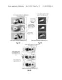 MEDICAL IMAGING DEVICES, METHODS, AND SYSTEMS diagram and image