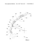 Methods and Apparatus for Delivering Ocular Implants Into the Eye diagram and image