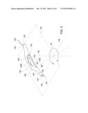 Methods and Apparatus for Delivering Ocular Implants Into the Eye diagram and image