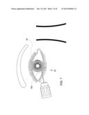 Methods and Apparatus for Delivering Ocular Implants Into the Eye diagram and image