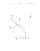 Methods and Apparatus for Delivering Ocular Implants Into the Eye diagram and image