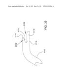 Methods and Apparatus for Delivering Ocular Implants Into the Eye diagram and image