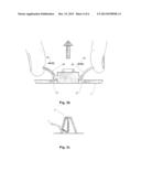 Removal of Cannula Part from Base Part diagram and image