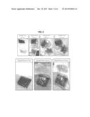 SILK FIBROIN-BASED MICRONEEDLES AND METHODS OF MAKING THE SAME diagram and image