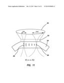 NONLINEAR OPTICAL PHOTODYNAMIC THERAPY (NLO-PDT) OF THE CORNEA diagram and image