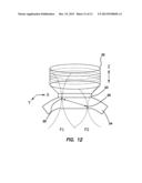 NONLINEAR OPTICAL PHOTODYNAMIC THERAPY (NLO-PDT) OF THE CORNEA diagram and image