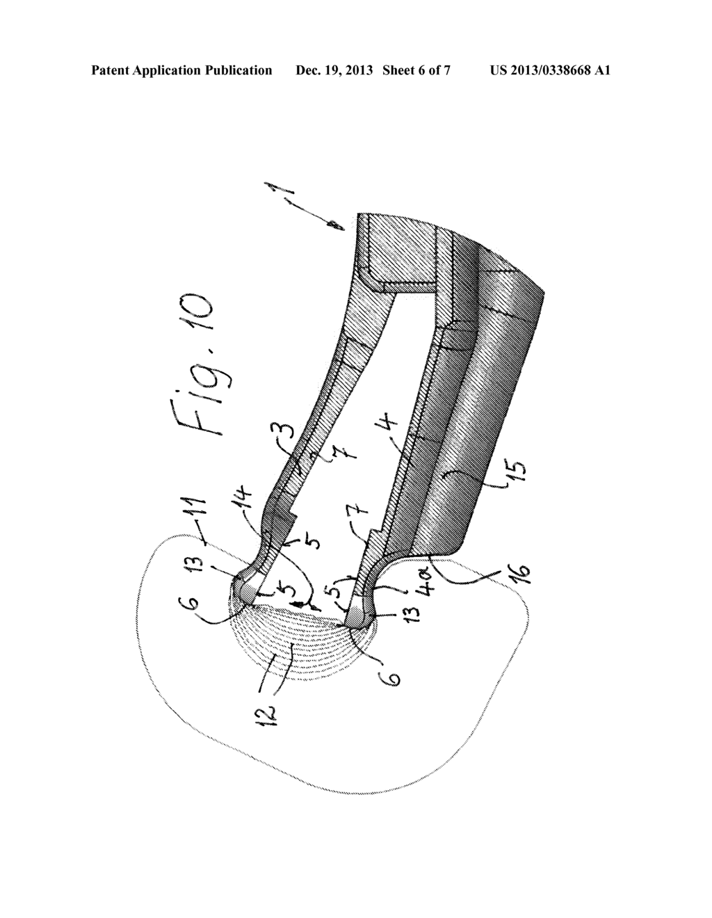 COAGULATION FORCEPS WITH A TUBULAR SHAFT - diagram, schematic, and image 07