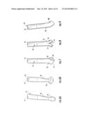 GUIDEWIRE AND METHOD FOR SURGICAL PROCEDURES diagram and image