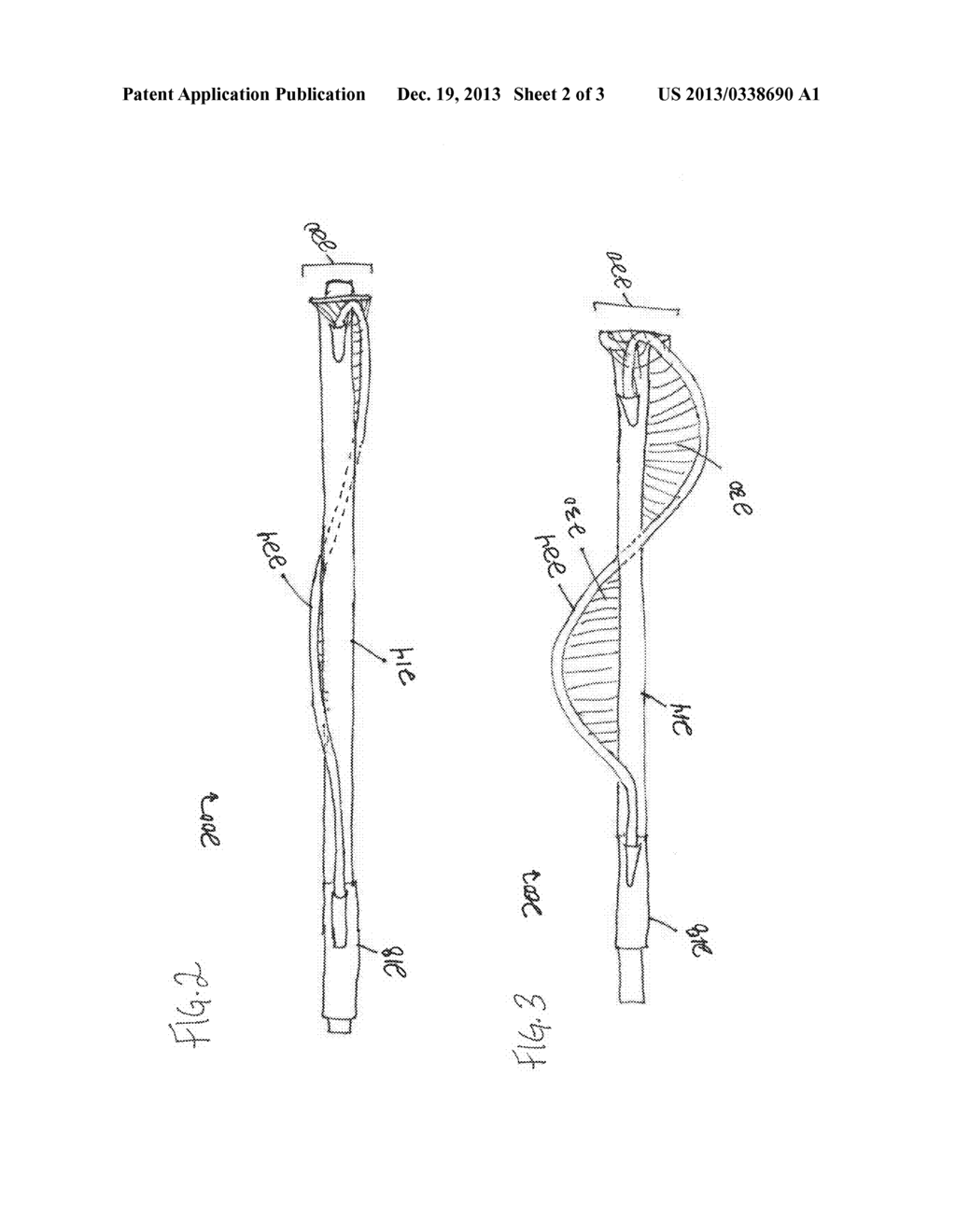 DEVICE AND METHOD FOR REMOVING UNWANTED MATERIAL IN A VASCULAR CONDUIT - diagram, schematic, and image 03