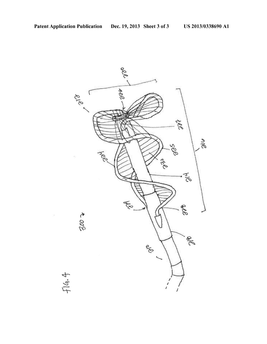 DEVICE AND METHOD FOR REMOVING UNWANTED MATERIAL IN A VASCULAR CONDUIT - diagram, schematic, and image 04