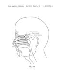 Biodegradable, Active Ingredient-Eluting Structural Support diagram and image