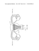 Biodegradable, Active Ingredient-Eluting Structural Support diagram and image