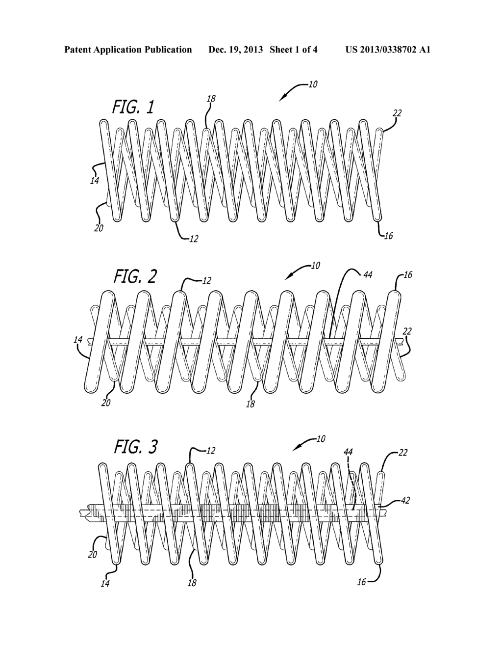 VASOOCCLUSIVE COIL WITH BIPLEX WINDINGS TO IMPROVE MECHANICAL PROPERTIES - diagram, schematic, and image 02