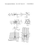 BLOOD VESSEL CLOSURE CLIP AND DELIVERY DEVICE diagram and image