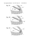 DEVICES AND METHODS FOR REDUCING CARDIAC VALVE REGURGITATION diagram and image