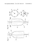 DEVICES AND METHODS FOR REDUCING CARDIAC VALVE REGURGITATION diagram and image