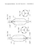 DEVICES AND METHODS FOR REDUCING CARDIAC VALVE REGURGITATION diagram and image