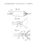 DEVICES AND METHODS FOR REDUCING CARDIAC VALVE REGURGITATION diagram and image