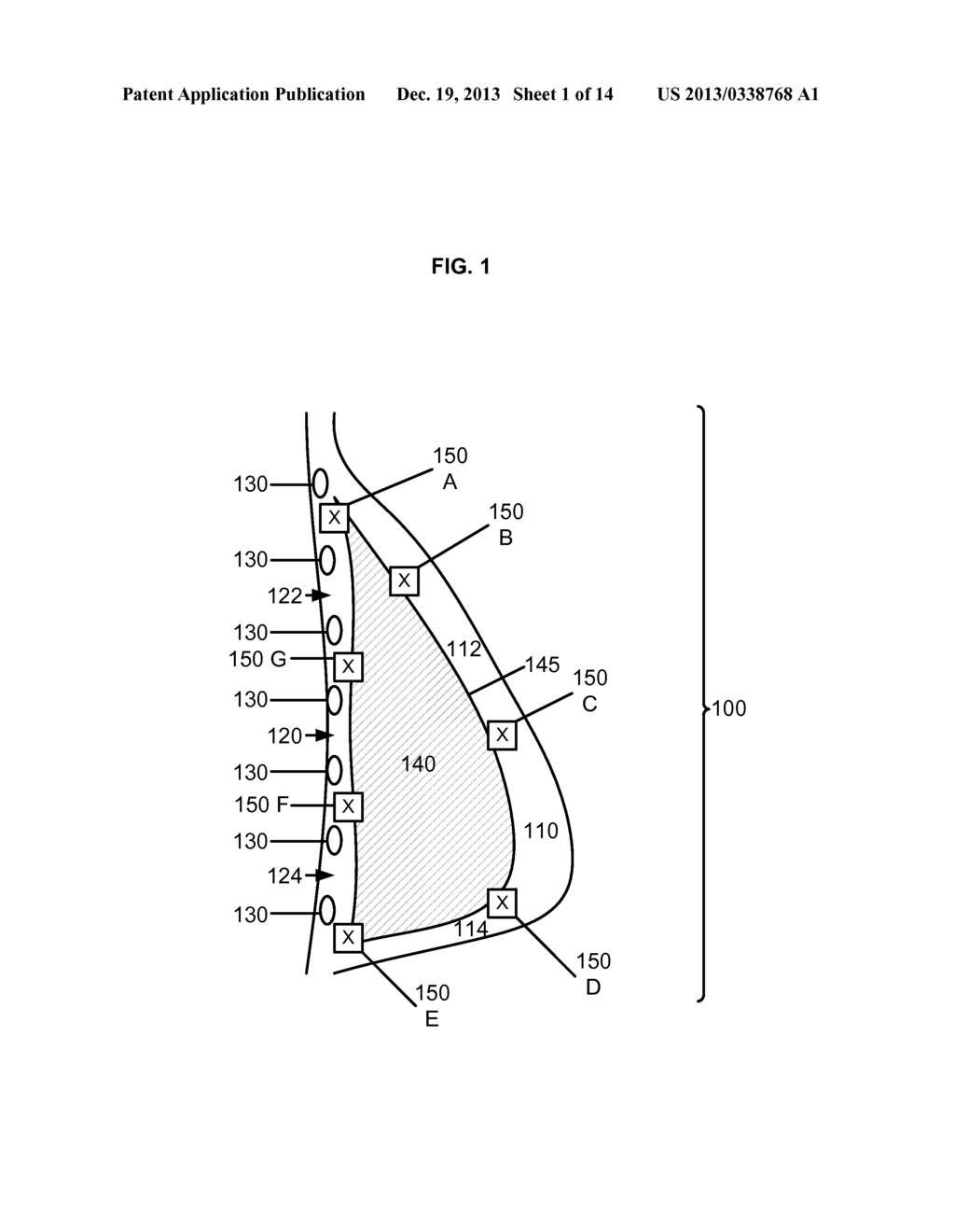 BREAST IMPLANT WITH ANALYTE SENSORS AND INTERNAL POWER SOURCE - diagram, schematic, and image 02