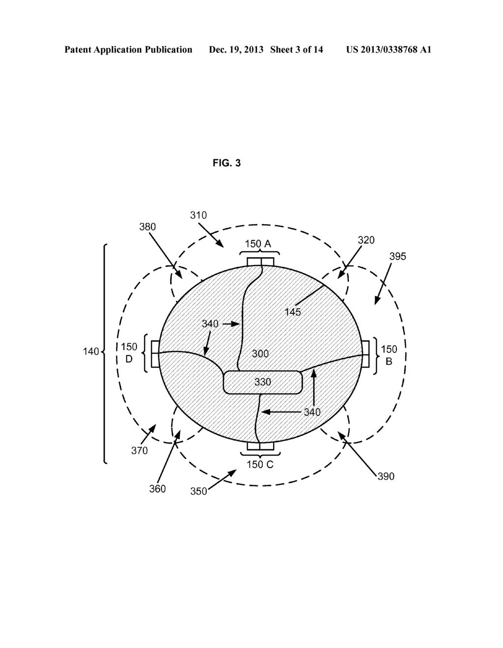 BREAST IMPLANT WITH ANALYTE SENSORS AND INTERNAL POWER SOURCE - diagram, schematic, and image 04