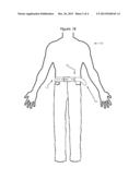 Excess Belt Loops diagram and image