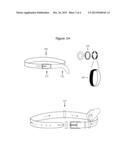 Excess Belt Loops diagram and image