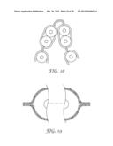 Shielded Electrical Cable diagram and image