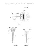 EARRING SET WITH AN AUDIO SPEAKER INTEGRATED THEREIN diagram and image