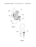 EARRING SET WITH AN AUDIO SPEAKER INTEGRATED THEREIN diagram and image