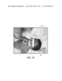 CONTINUOUS CARDIAC PULSE RATE ESTIMATION FROM MULTI-CHANNEL SOURCE VIDEO     DATA diagram and image