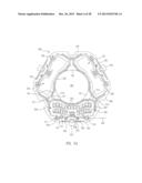 MEMS Actuator Alignment diagram and image