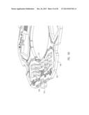 MEMS Actuator Alignment diagram and image