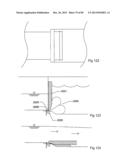 Water Control Apparatus diagram and image