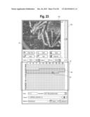 Mass-Spectral Method for Selection, and De-Selection, of Cancer Patients     for Treatment with Immune Response Generating Therapies diagram and image