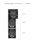 METHODS AND COMPOSITIONS FOR TREATMENT OF ADD/ADHD, DEPRESSION, MEMORY     PROBLEMS AND OTHER CONDITIONS diagram and image