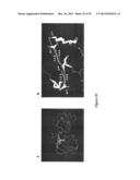 HEPATITIS C VIRUS VARIANTS diagram and image