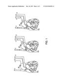 DECELLULARIZATION AND RECELLULARIZATION OF SOLID ORGANS diagram and image