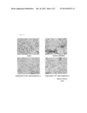 Adiponectin for Treating Pulmonary Disease diagram and image