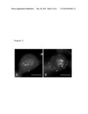 USE OF STATHMIN AS A BIOMARKER OF DRUG RESPONSE TO FURAZANOBENZIMIDAZOLES diagram and image