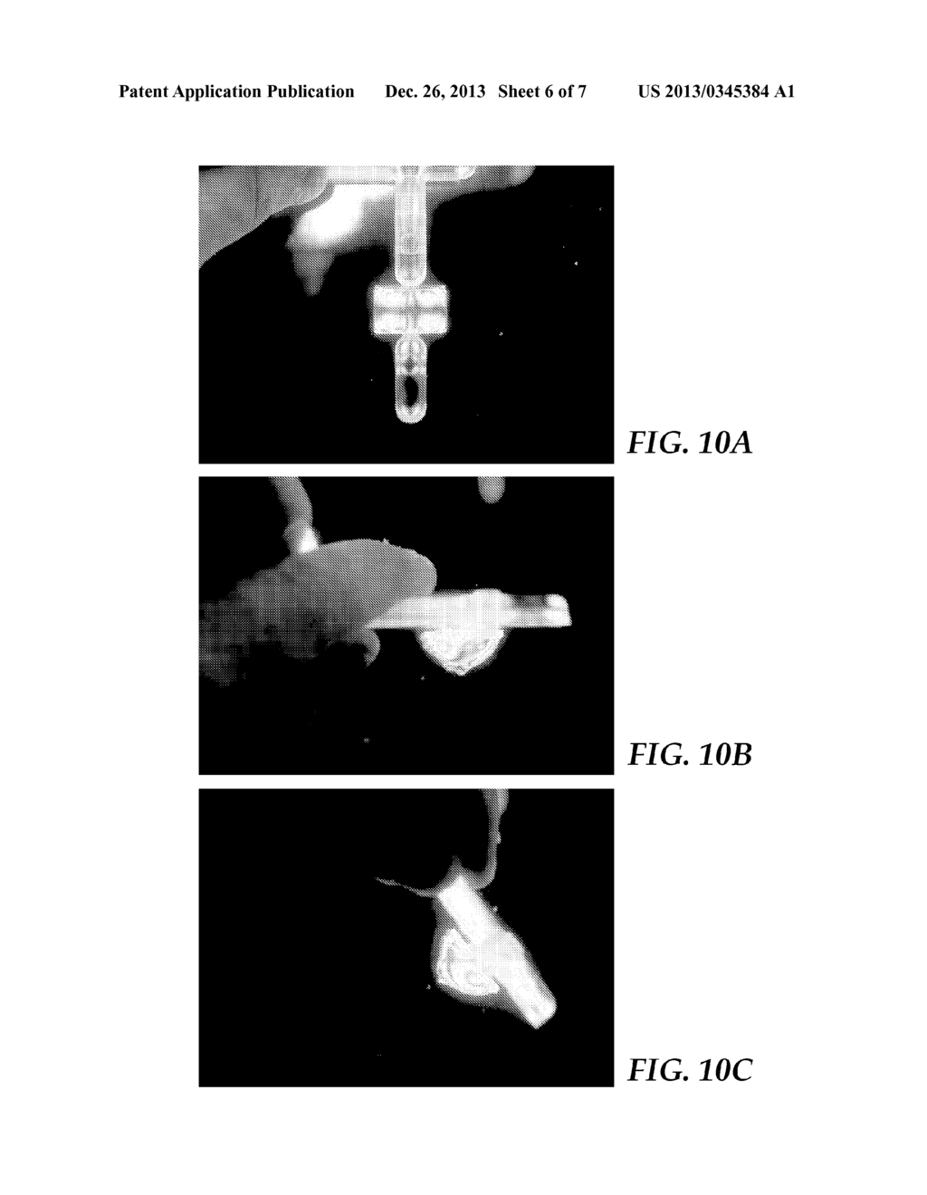 ULTRASONIC-ASSISTED MOLDING OF PRECISELY-SHAPED ARTICLES AND METHODS - diagram, schematic, and image 07